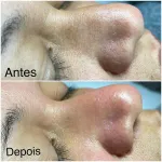 Limpeza de pele e massagens  1