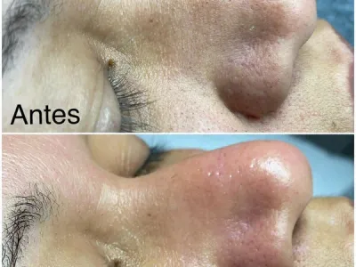 Limpeza de pele e massagens 