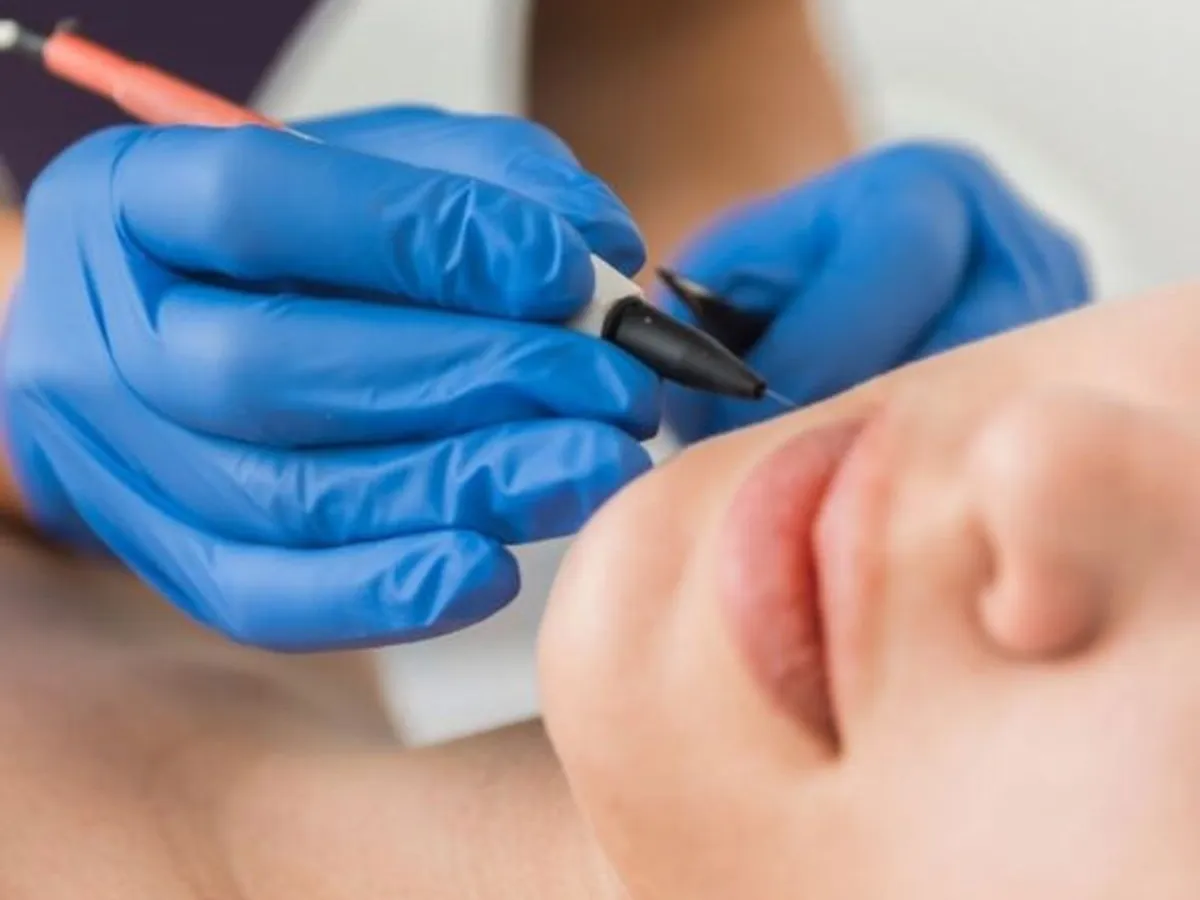 Depilação eléctrica 