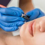 Depilação eléctrica  1