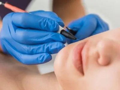 Depilação eléctrica 