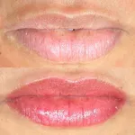 Sobrancelhas alinhadas! 3